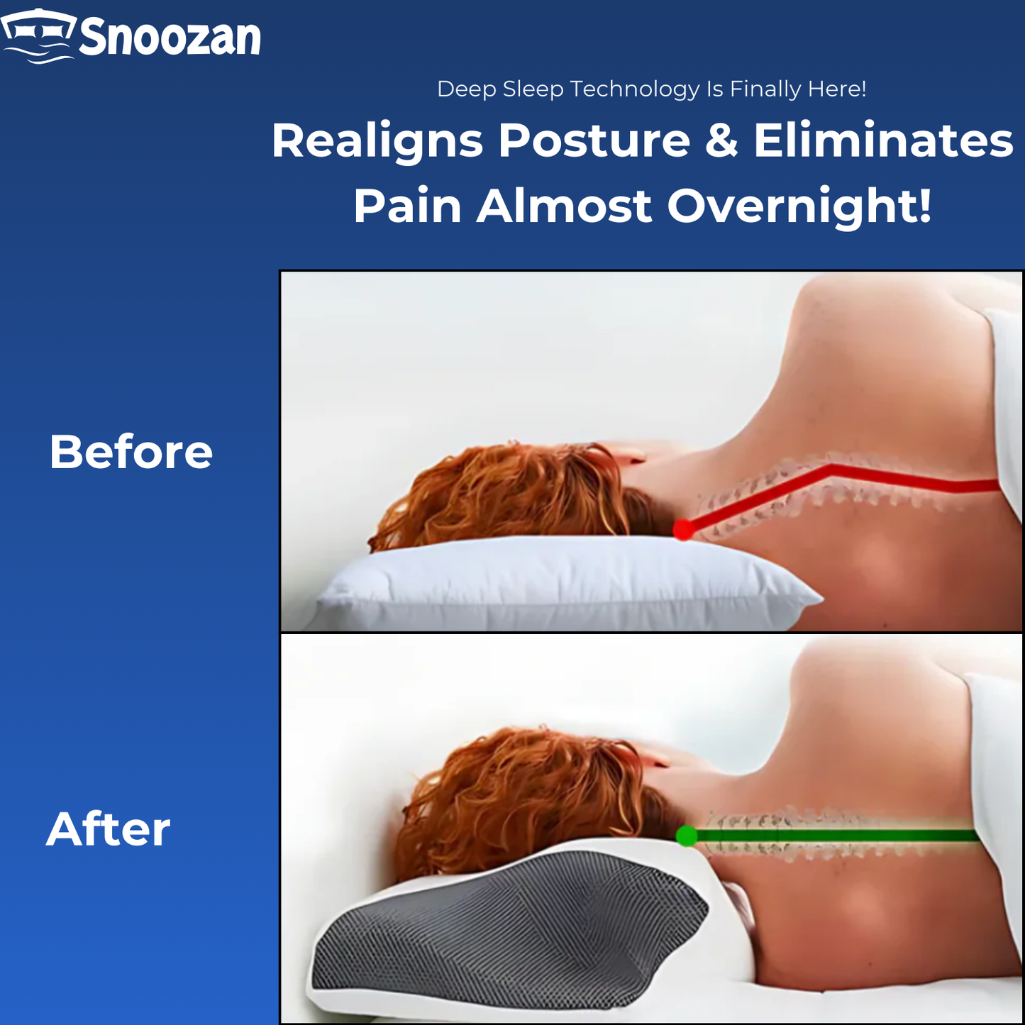 Snoozan™ Ergonomic Pillow